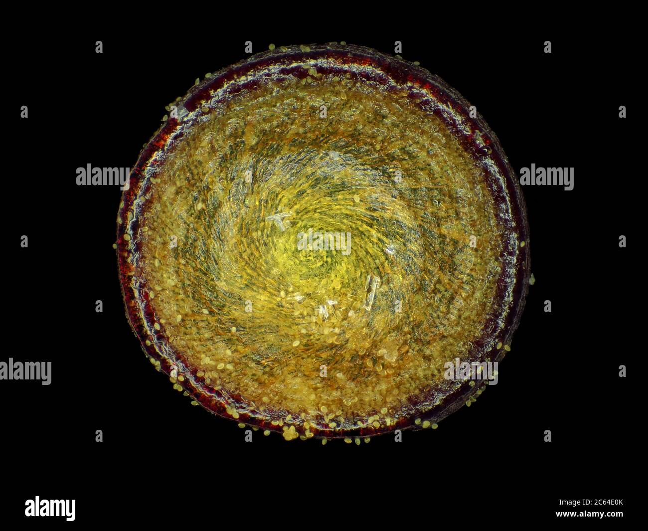 Moss operculum (spore capsule lid), about 0.9mm in diameter, under the microscope Stock Photo