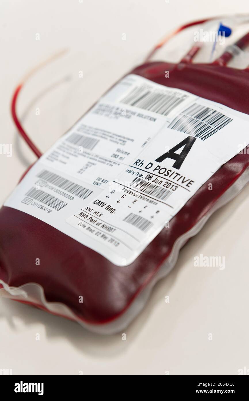 A sample of A Positive blood in a sealed bag at a hospital. Stock Photo