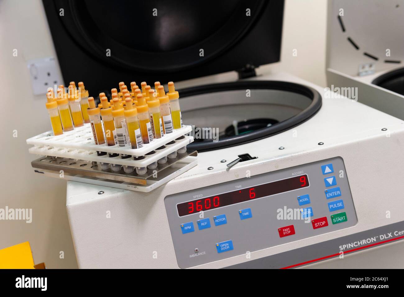 Samples of blood on the side of a centrifuge waiting for testing at a hospital Stock Photo