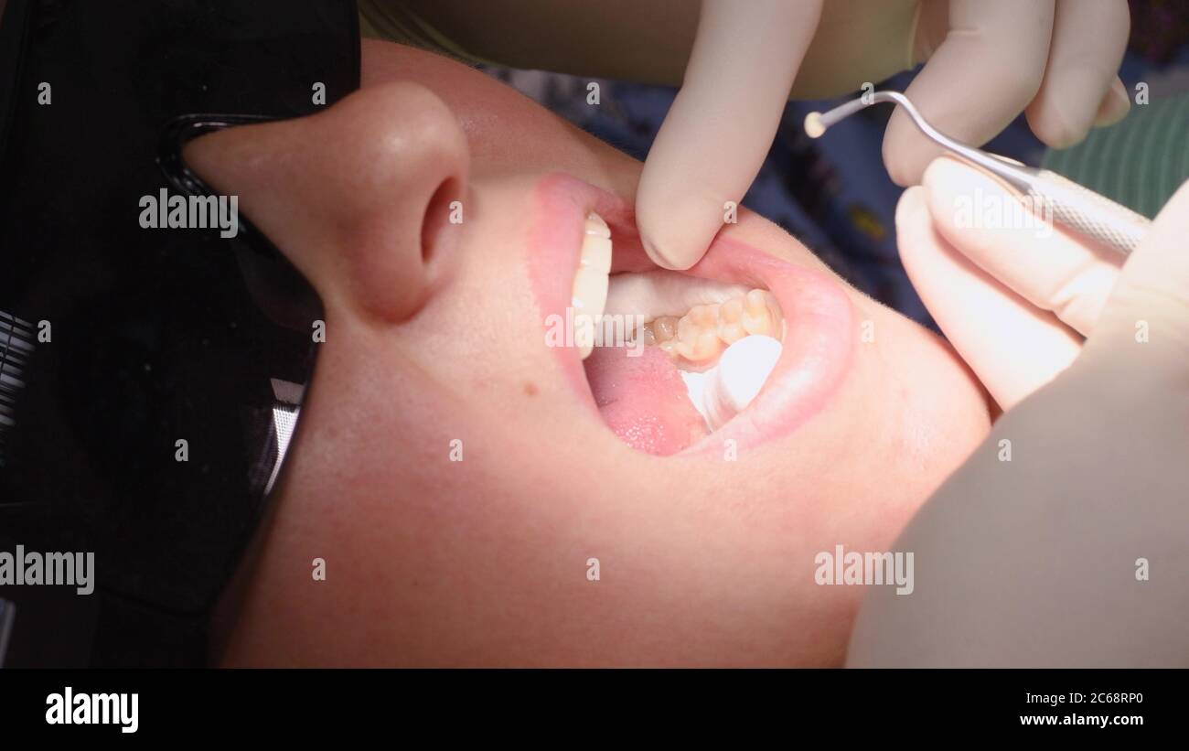 Young woman at dental clinic Stock Photo
