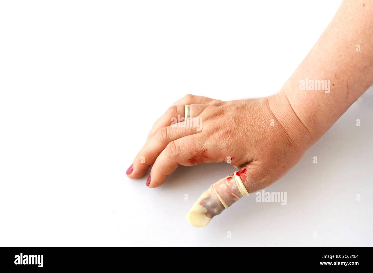 First Aid Cut Finger Tip