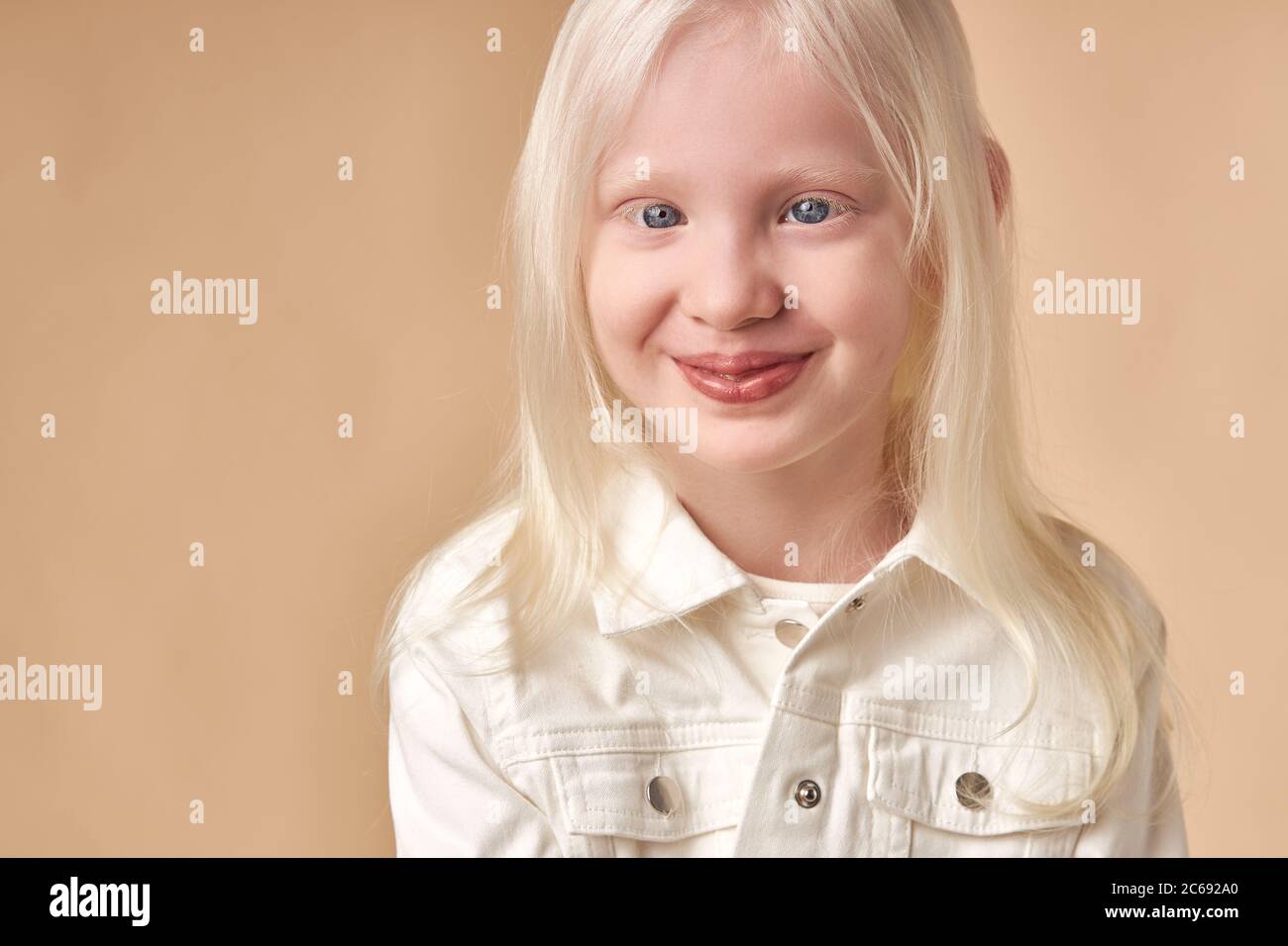 Albino Model High Resolution Stock Photography And Images Alamy