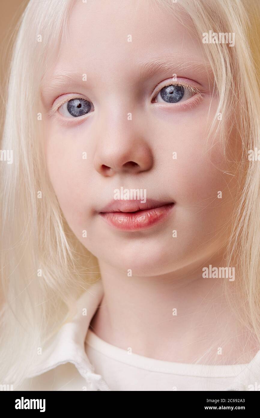 portrait of awesome albino kid with blonde hair. Fashion style and beauty  look. Child with unusual young tender white skin. albinism, children,  people Stock Photo - Alamy