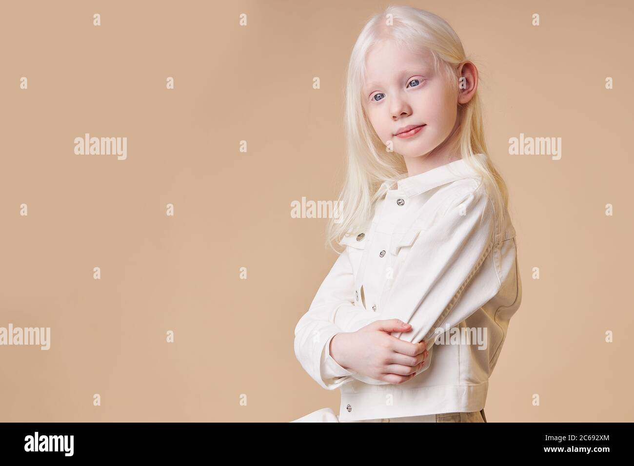 adorable albino girl 7-9 years old posing at camera isolated. shy little  caucasian child with unusual natural blonde hair and white skin born with  alb Stock Photo - Alamy
