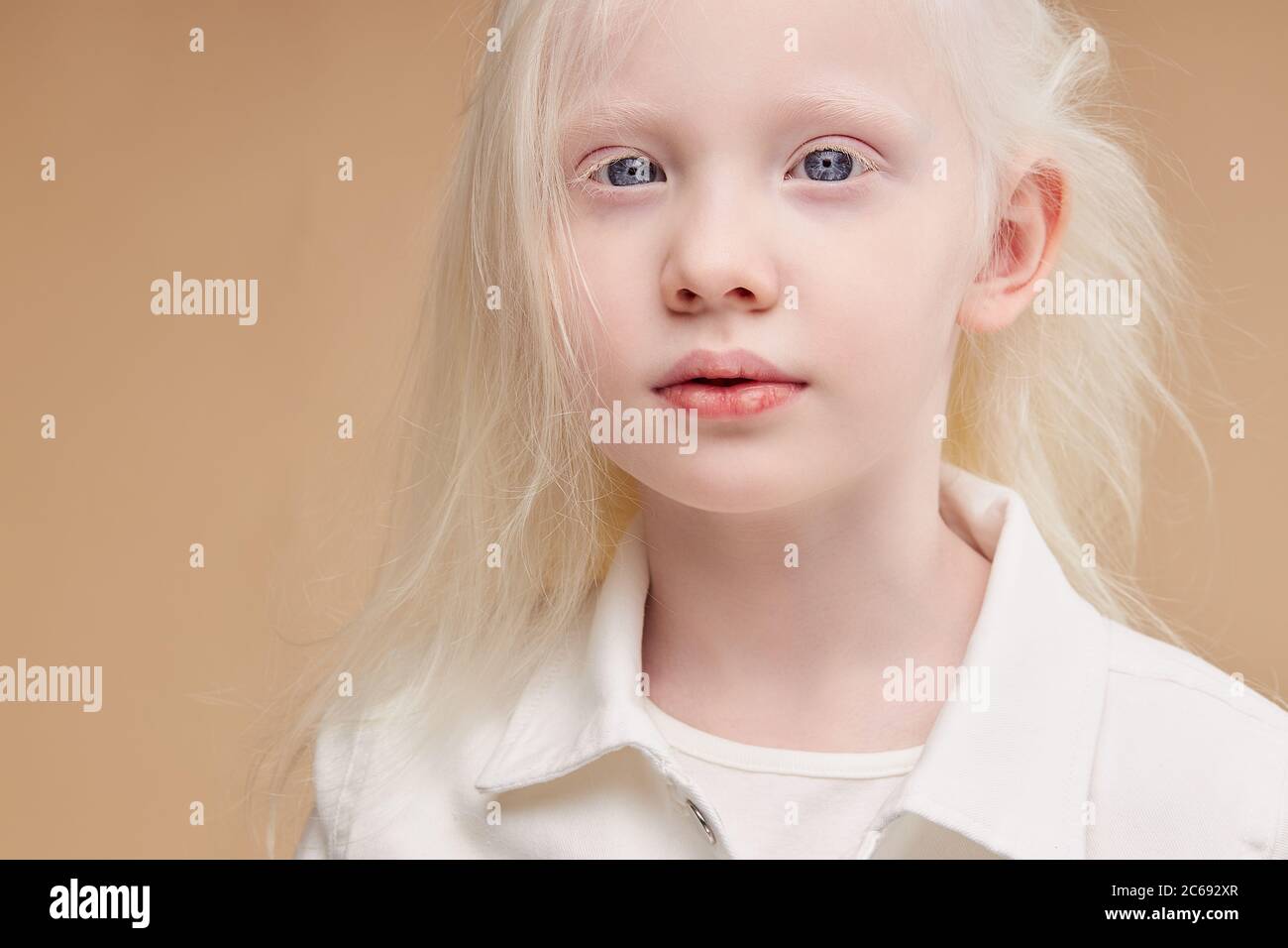 Albino Model High Resolution Stock Photography And Images Alamy