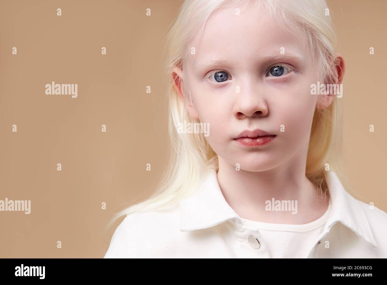 Portrait Of Albino Kid Girl With White Skin And White Hair Blonde Girl With Unusual Natural Beauty Albinism Concept Stock Photo Alamy