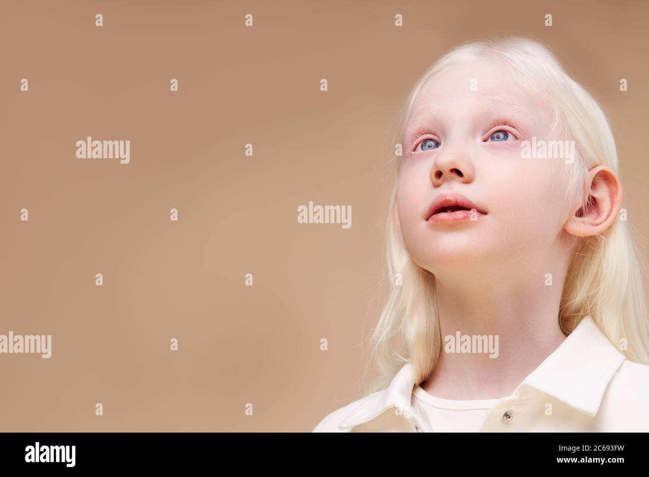 Albino