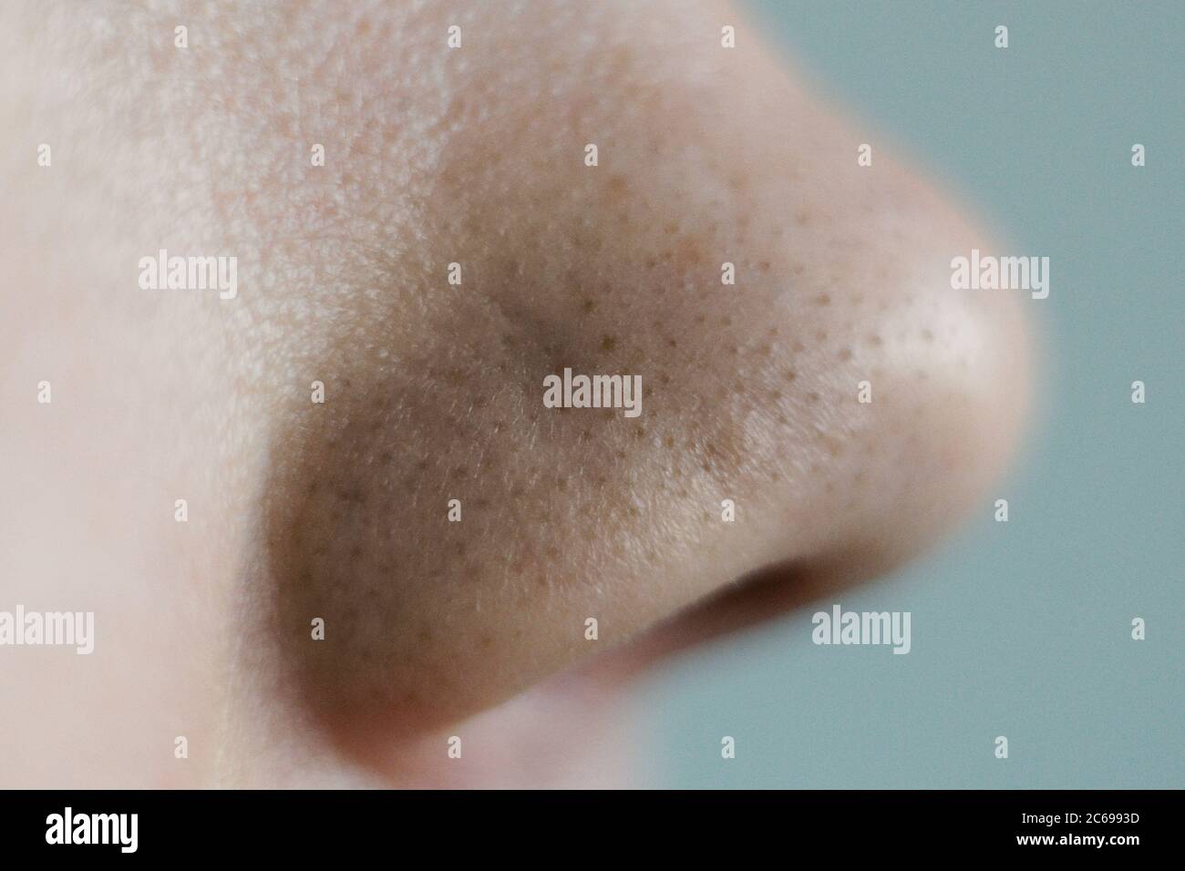 Black dots on the nose. Close up. Nose profile. Stock Photo