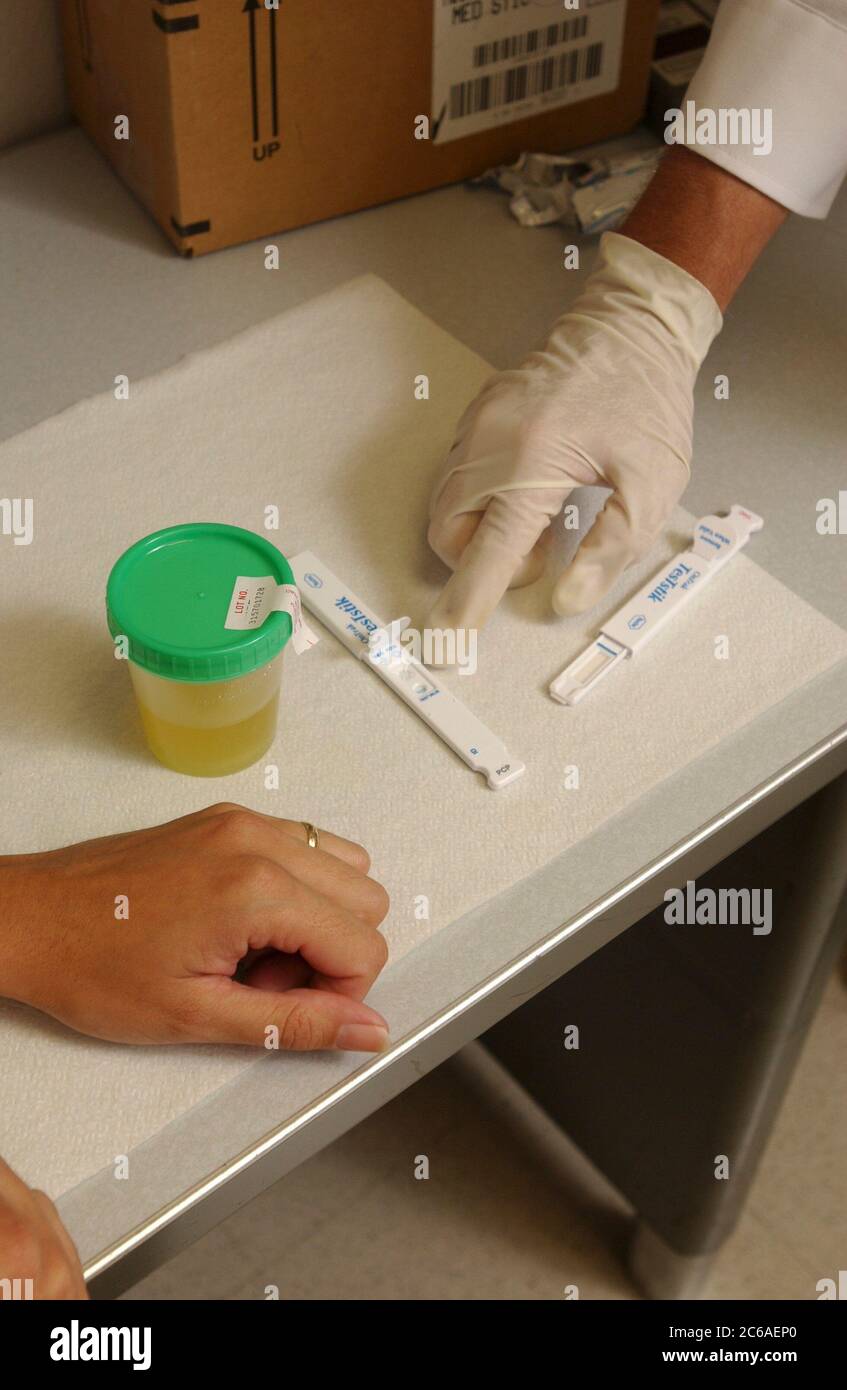 Austin, Texas USA, August 28, 2003 Sample urine test done at Adult