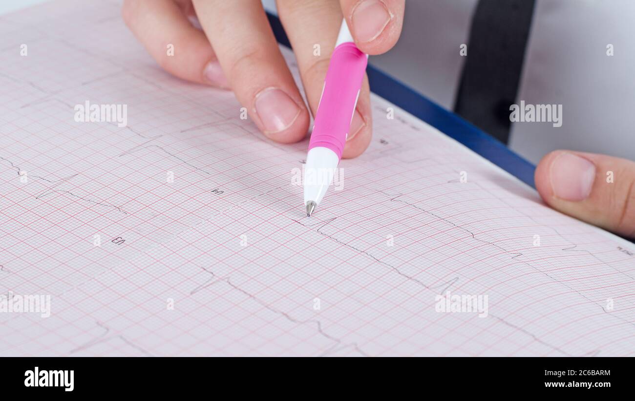 Electrocardiogram in the hands of doctor Stock Photo