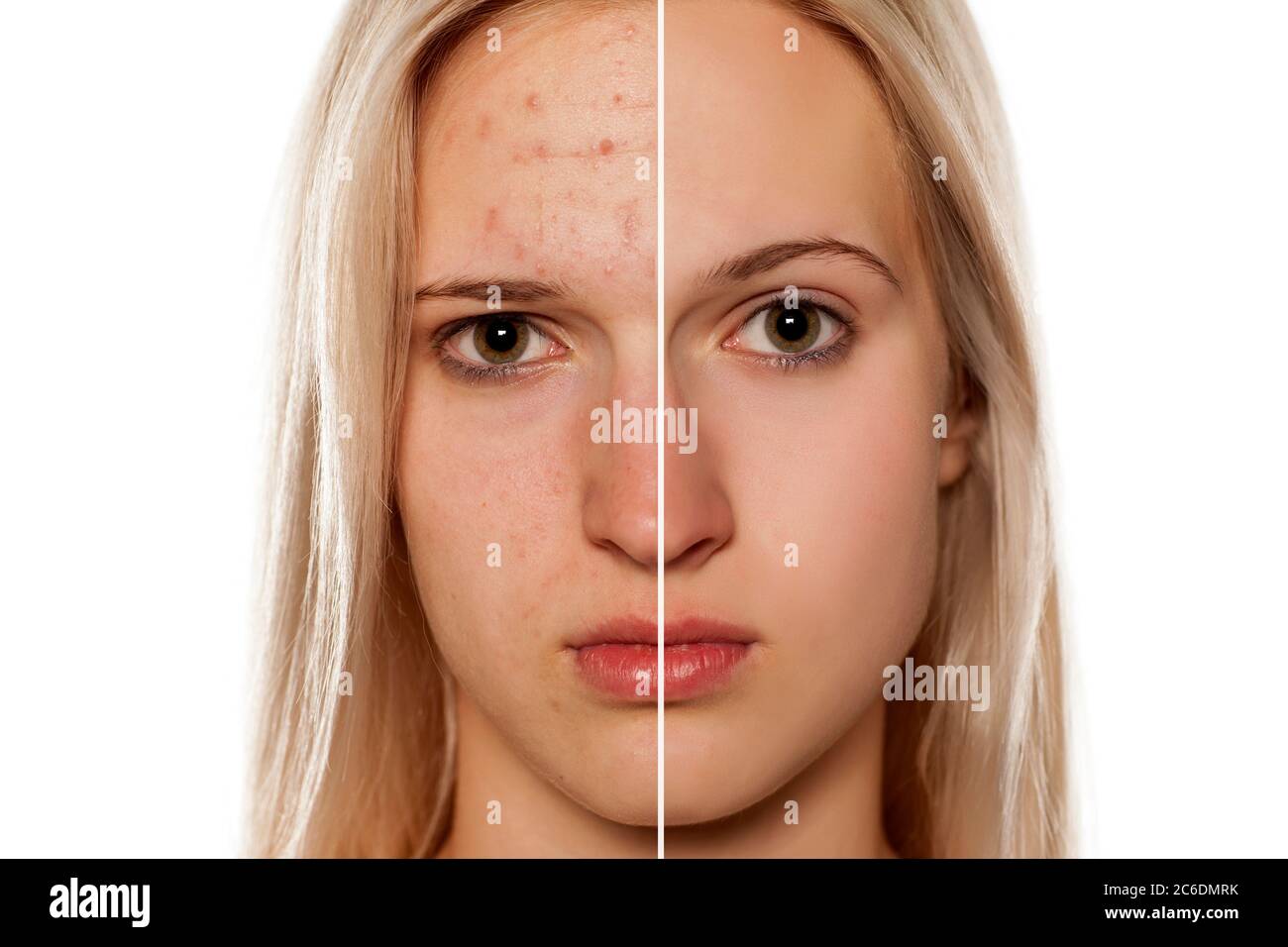 Before and after photoshop hi-res stock photography and images - Alamy