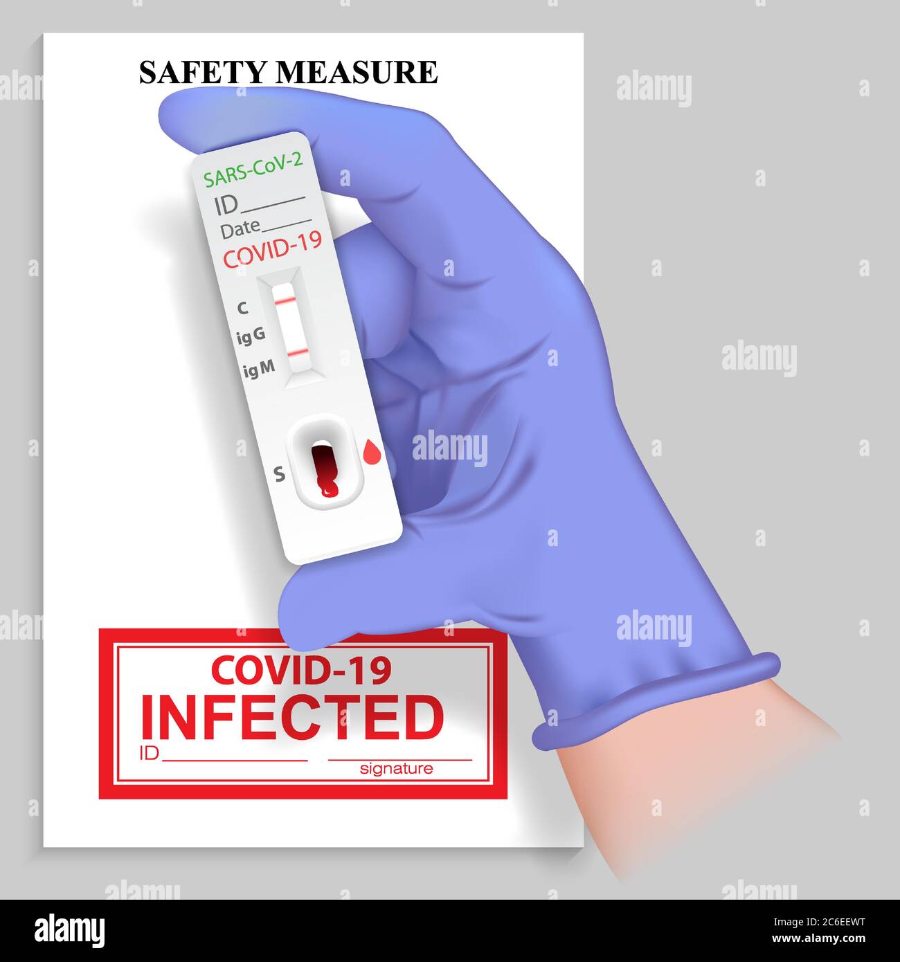 Hand in medical glove holding rapid test for antibodies to coronavirus with positive Ig M result. Presence Covid 19 virus and infectious disease Sars Stock Vector