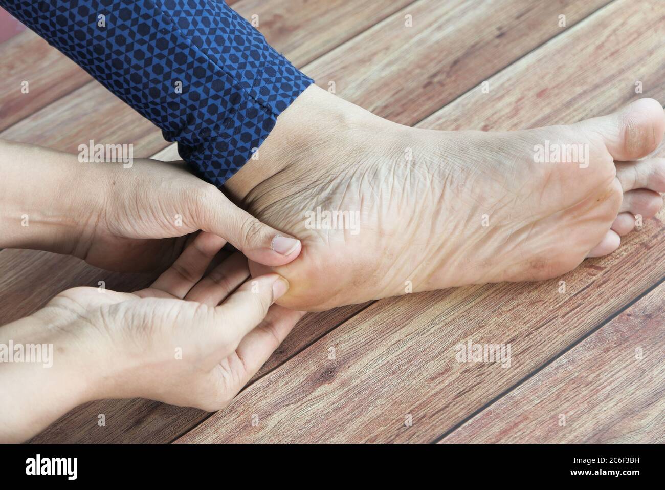 Close up on women feet and hand massage on injury spot. Stock Photo
