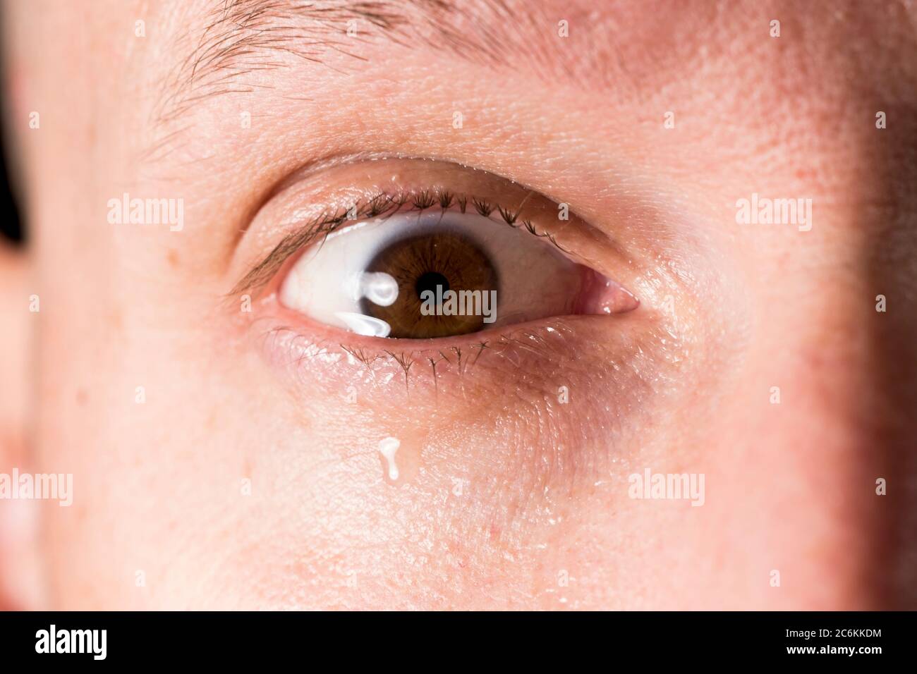 Close Up Of Eye With Tear High Resolution Stock Photography And Images Alamy Close Up Of Eye With Tear High Resolution Stock Photography And Images Alamy