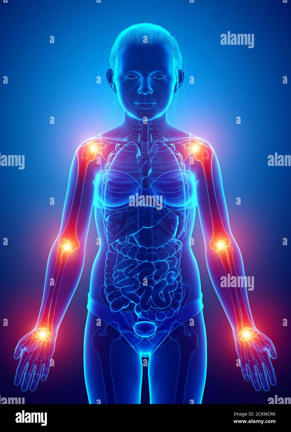 3d Illustration of young girl arm joint pain Stock Photo Alamy