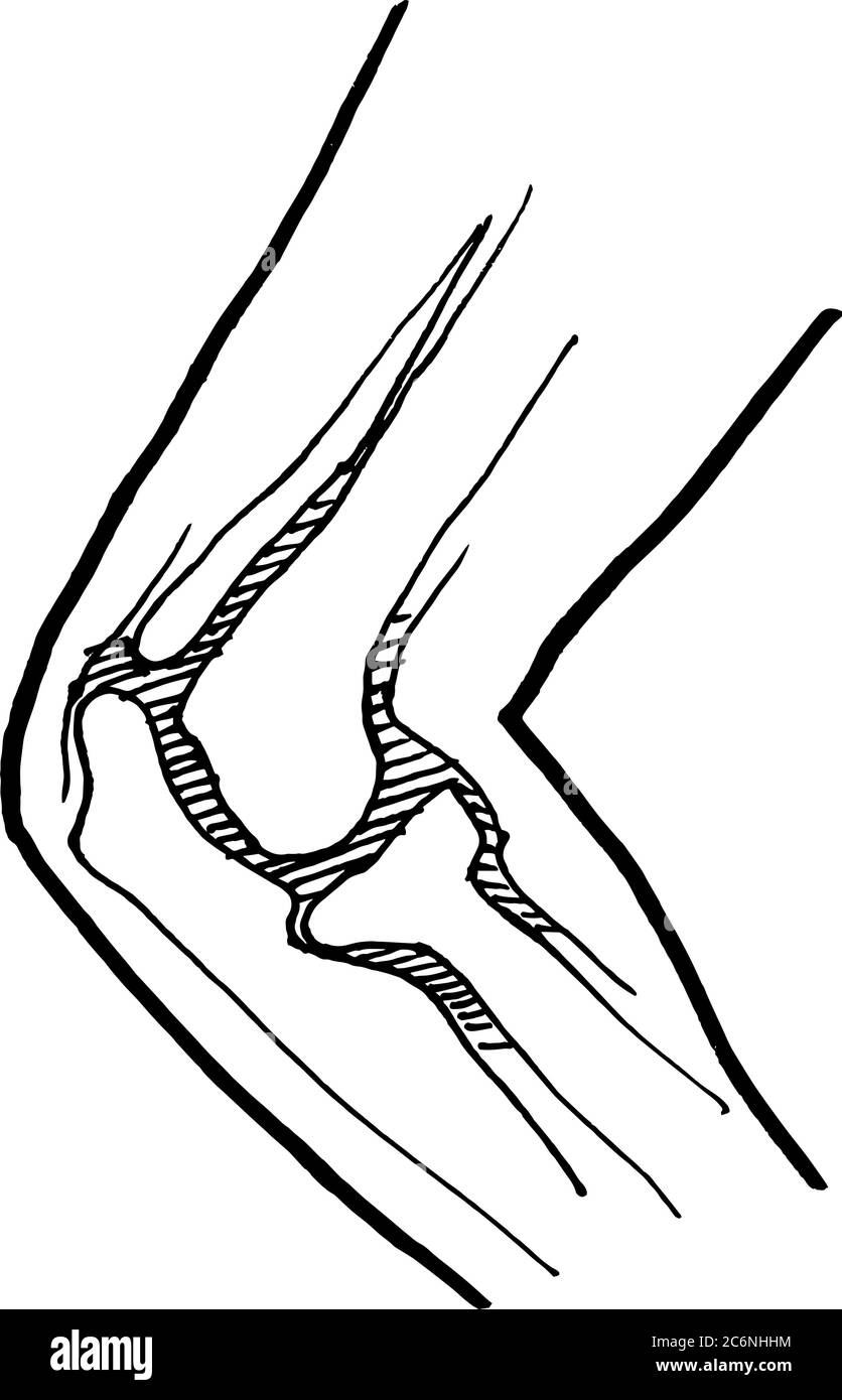 Contour vector outline drawing of human injured knee bones. Medical design editable template Stock Vector