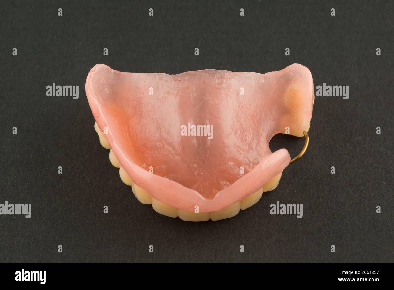 acrylic dental prosthesis with metal retaining elements on black
