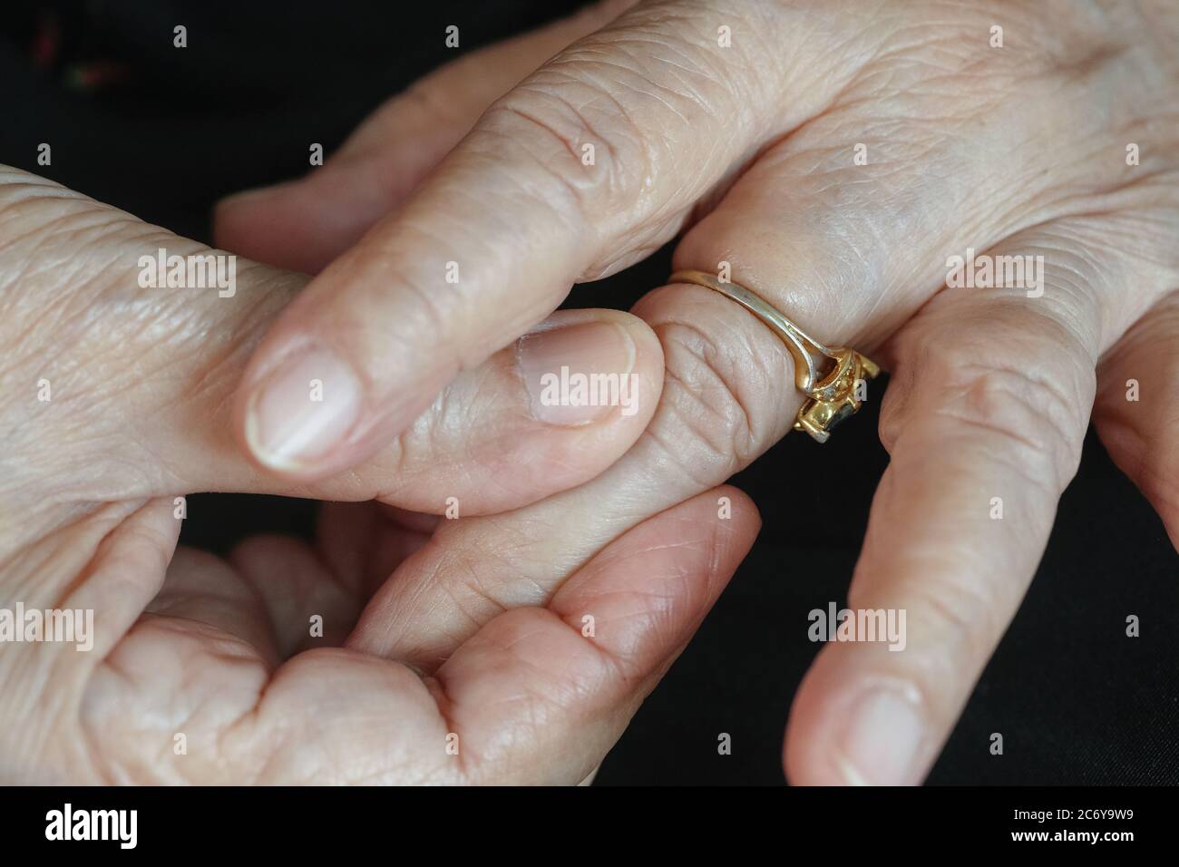 Elderly woman try to remove stuck ring off a swollen finger Stock Photo