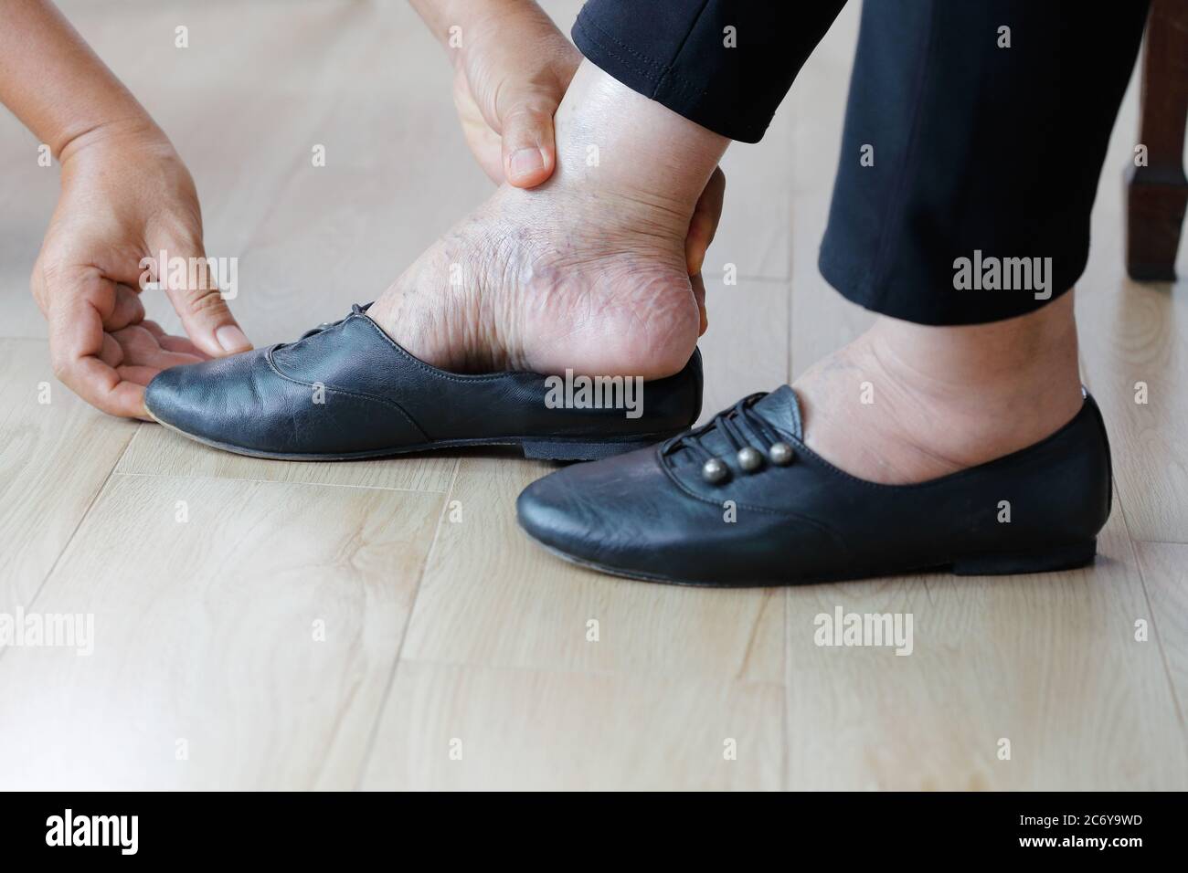 Elderly woman swollen feet putting on shoes with care giver. Stock Photo