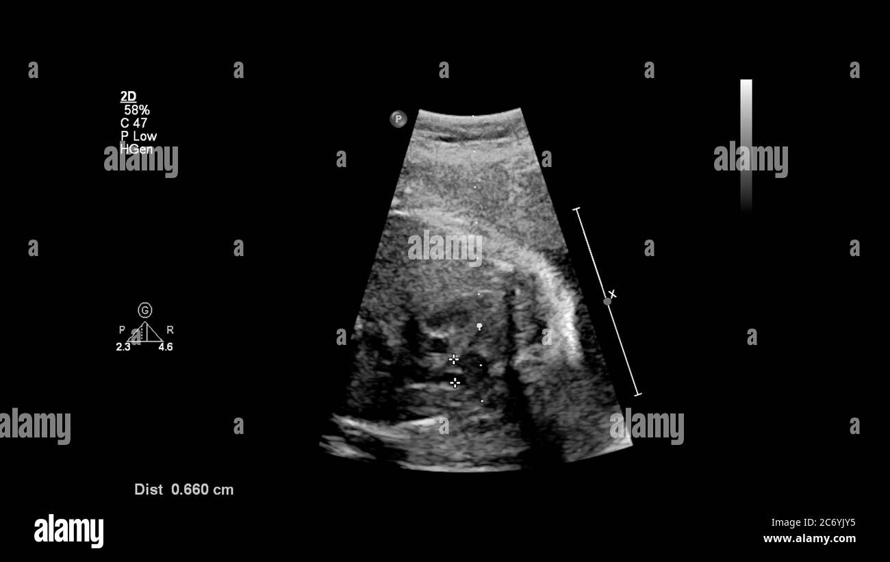 Fetal echocardiography examination hi-res stock photography and images -  Alamy