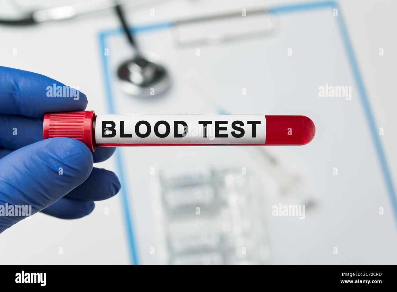 Hand in medical glove holding blood test. Tube of biological sample ...