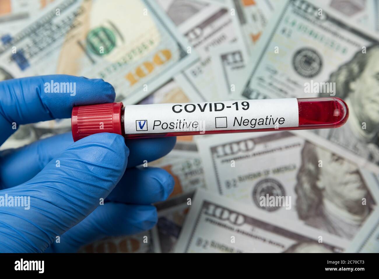 Test tubes with blood sample on coronavirus. Money background. How much