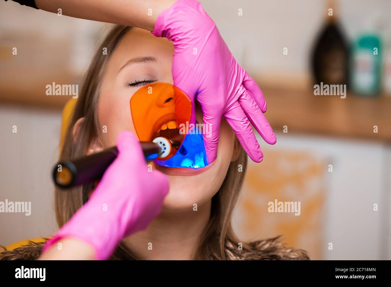 dentist use UV light to finalize young blonde patient's tooth Stock