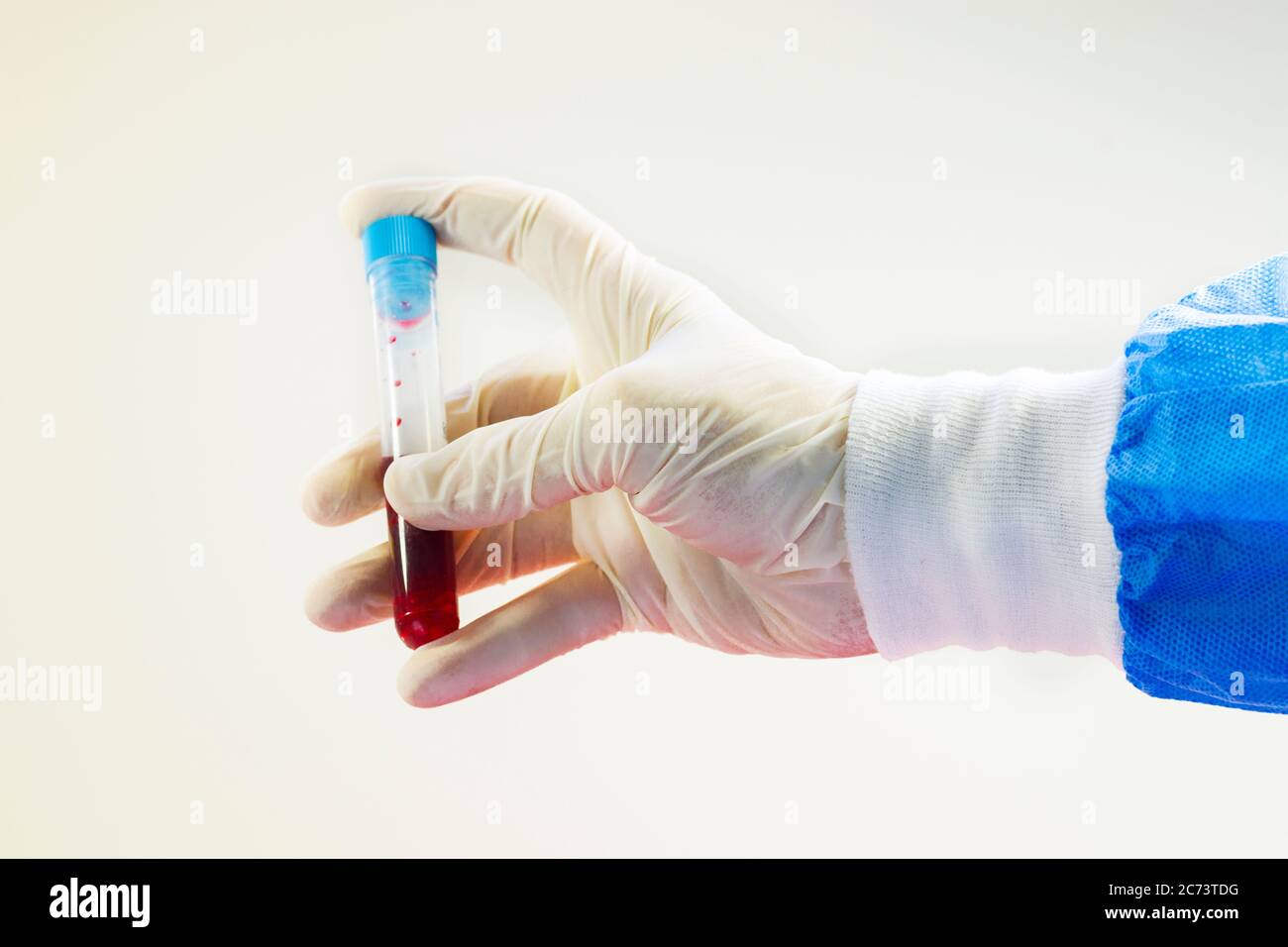 Blood test full tubes in doctor's hand, on the white background, studio ...