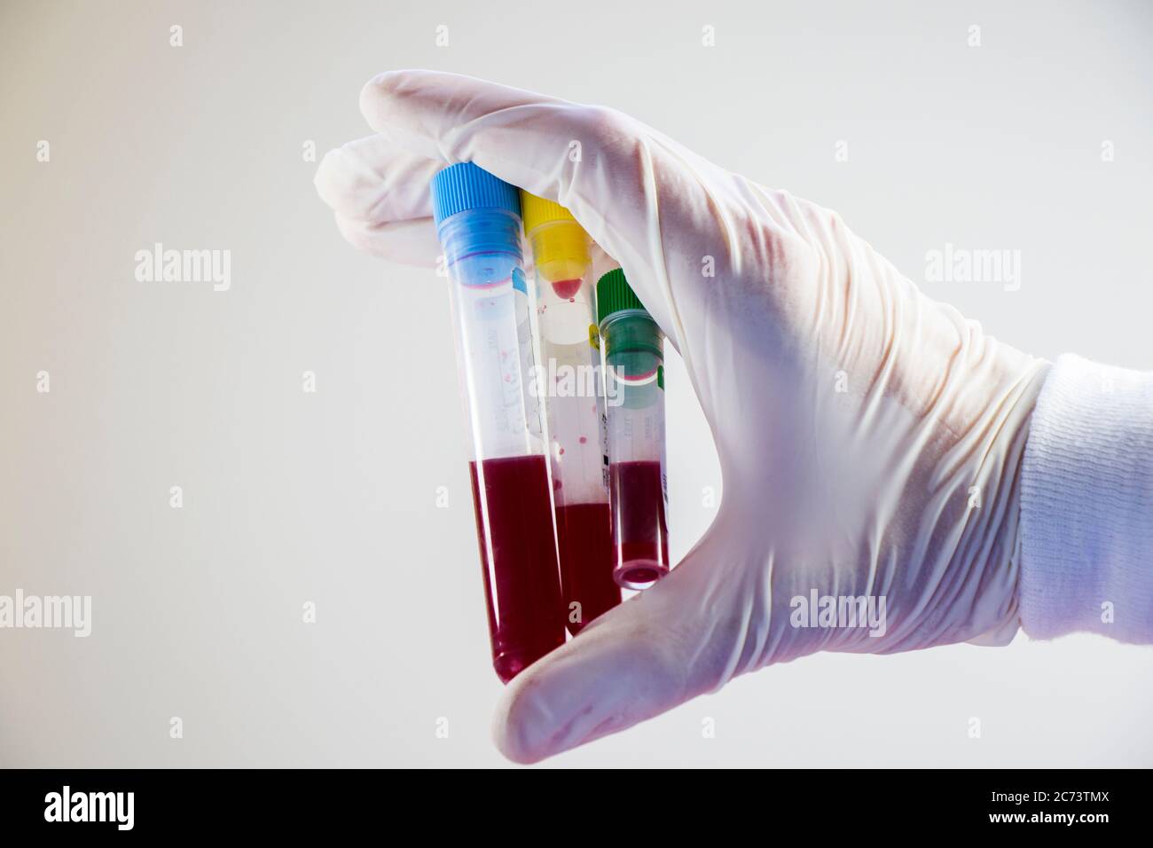 Blood test full tubes in hand, holding tubes,on the white background ...