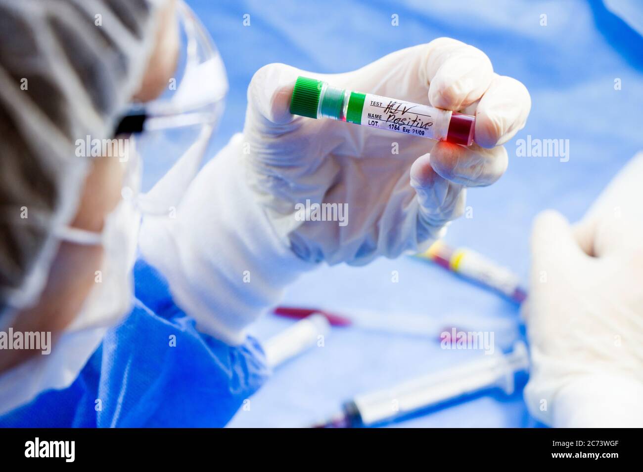 Hiv and aids infection test, doctors face and hand holding tube with ...