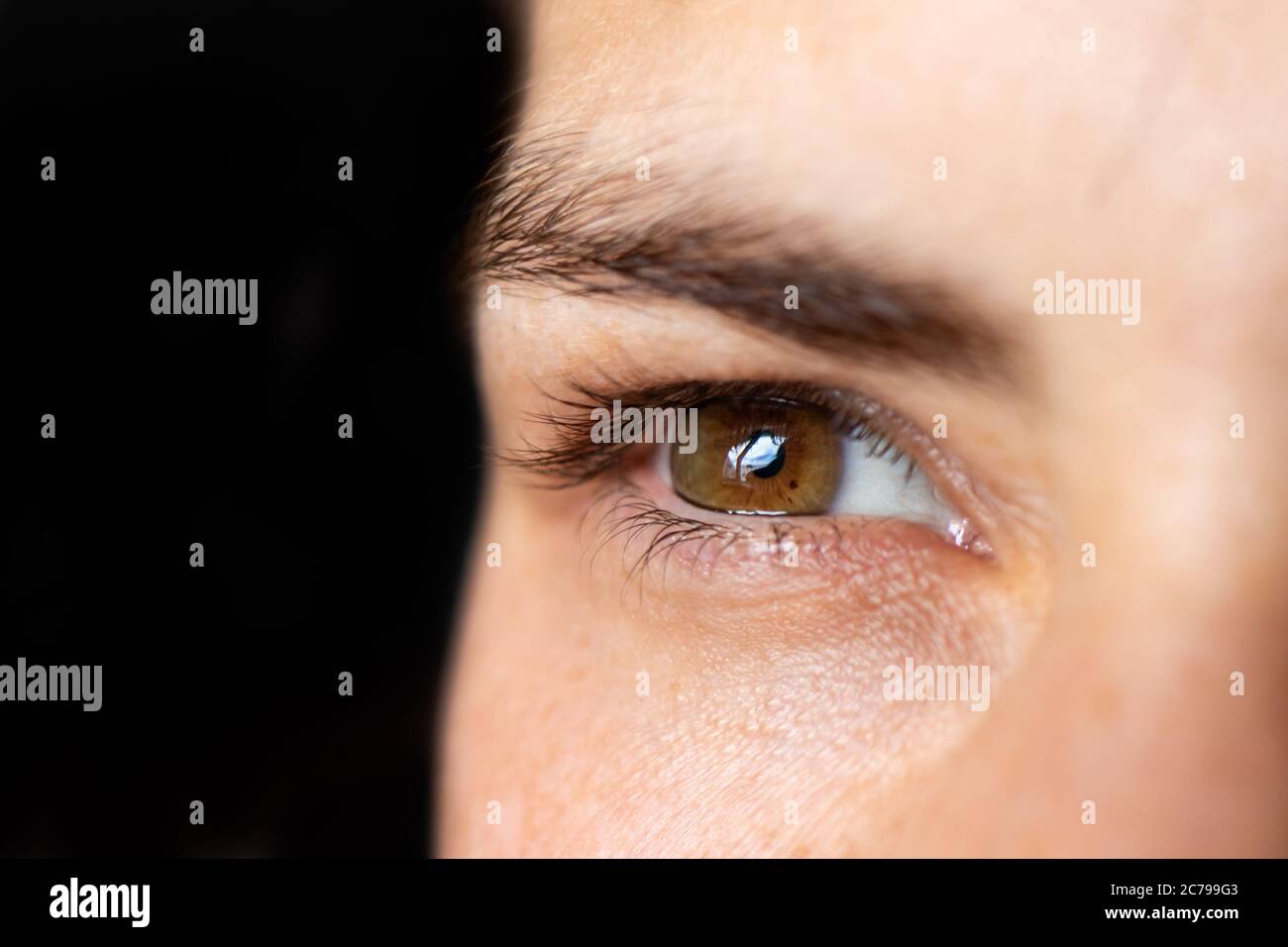 Macro eye photo. Keratoconus - eye disease, thinning of the cornea in the form of a cone. The cornea plastic Stock Photo