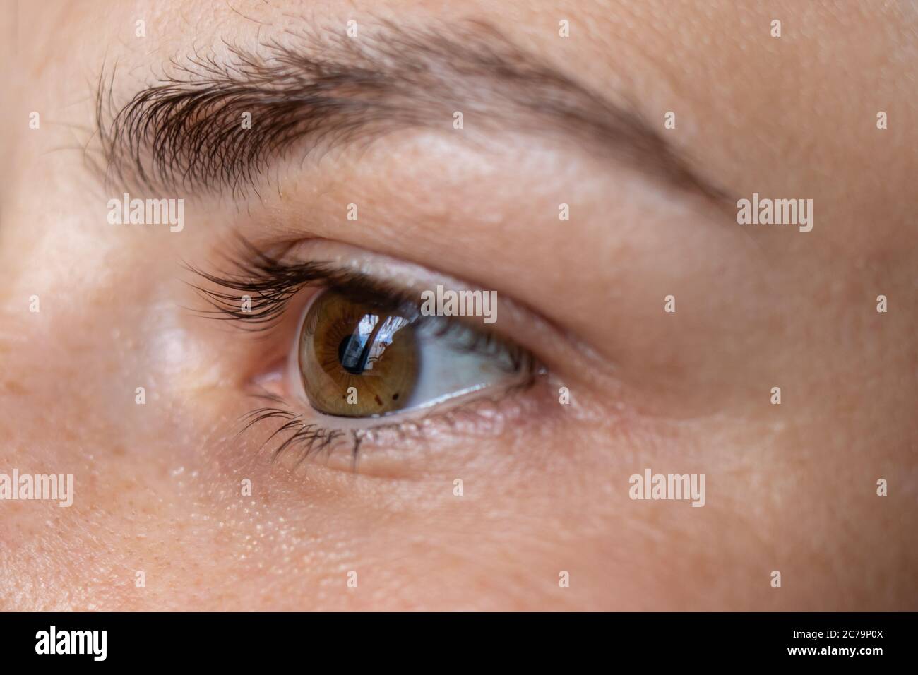 Macro eye photo. Keratoconus - eye disease, thinning of the cornea in the form of a cone. The cornea plastic Stock Photo