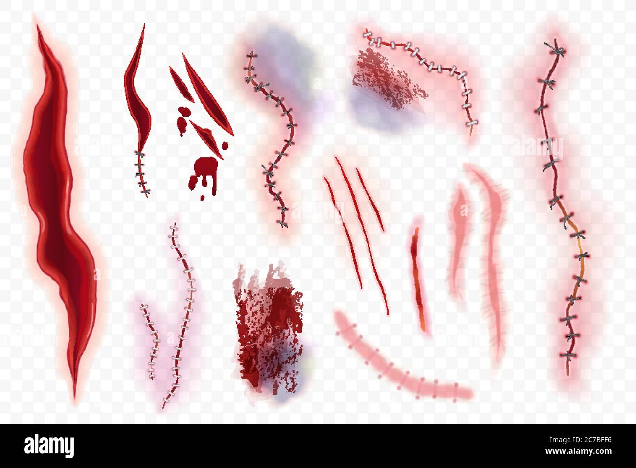 Realistic surgical stitches, scars, bruise and slaughter set isolated on the alpha transperant background. Bloody scar. Stock Vector
