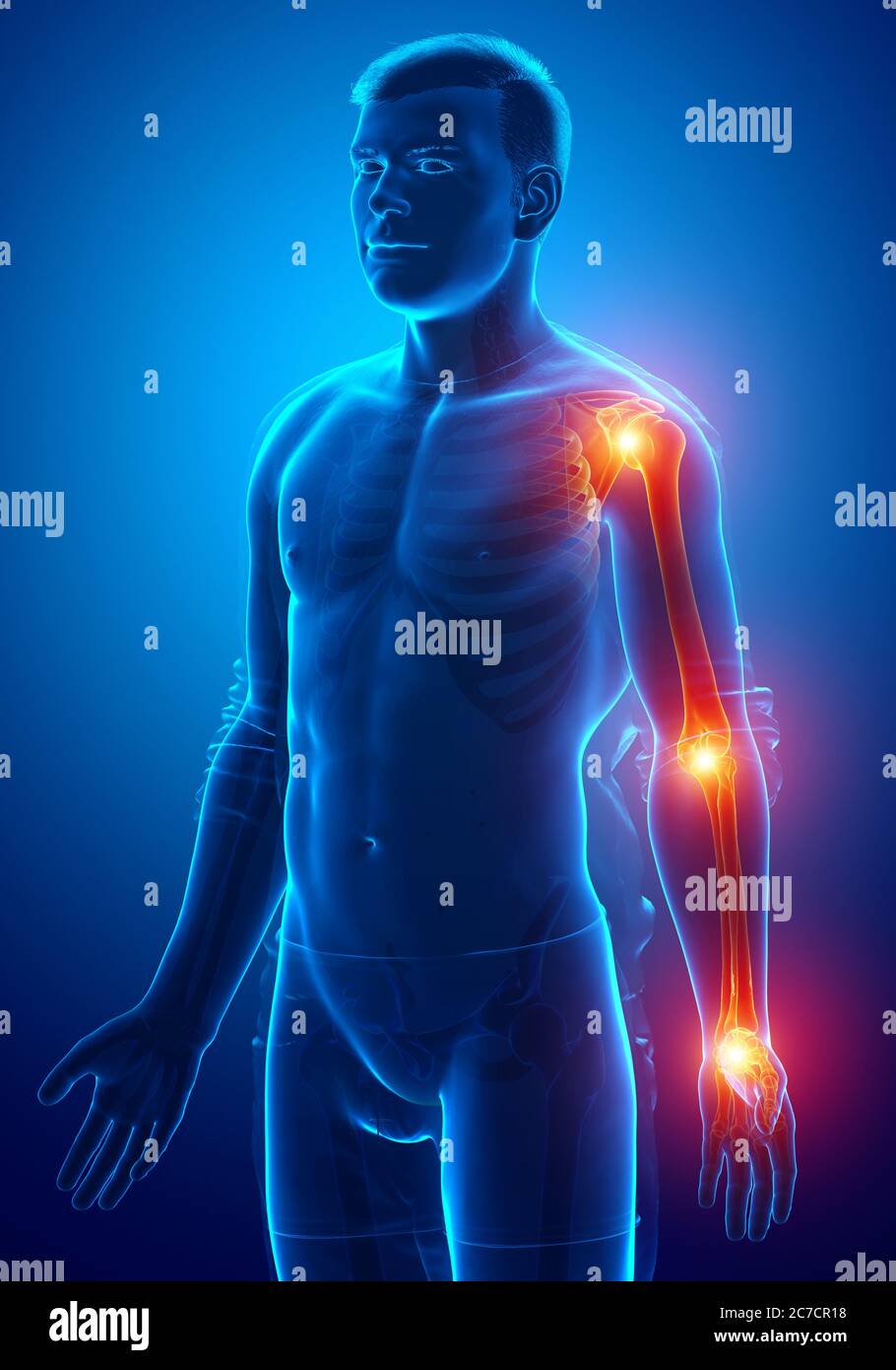 3d Illustration of men arm joint pain Stock Photo Alamy