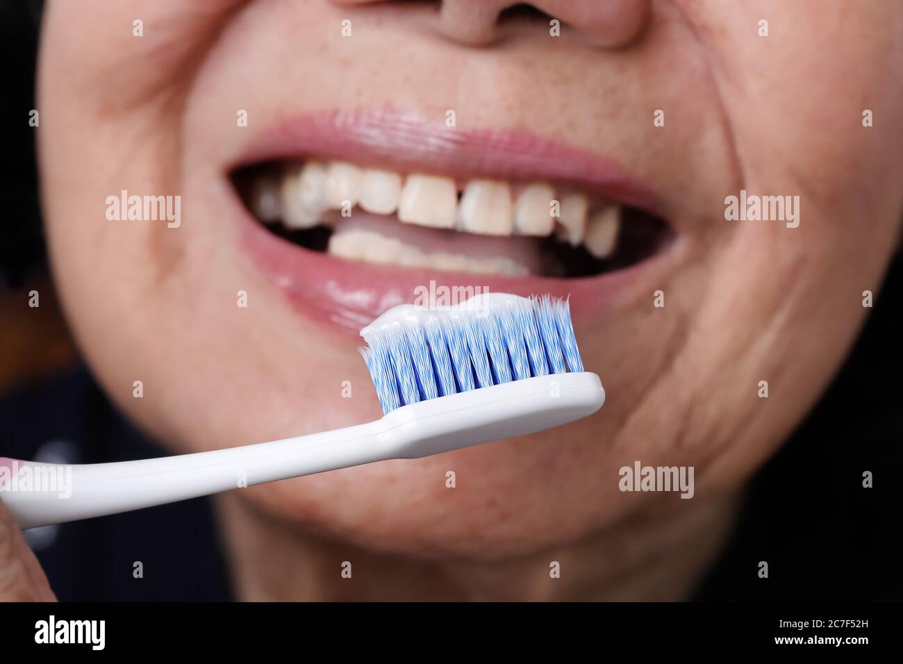 Asian elderly woman trying use toothbrush ,hand tremor . Dental health Stock Photo