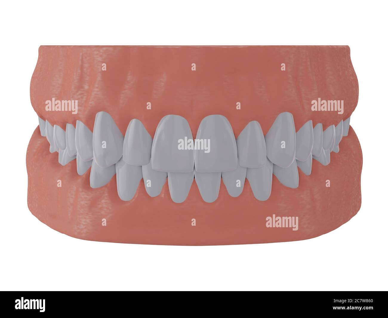 Correct prosthetic hires stock photography and images Alamy