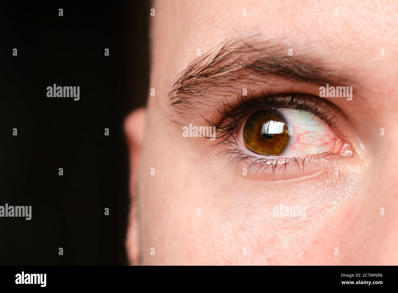 Close up mans bloodshot or red eyes on a black background, caused by