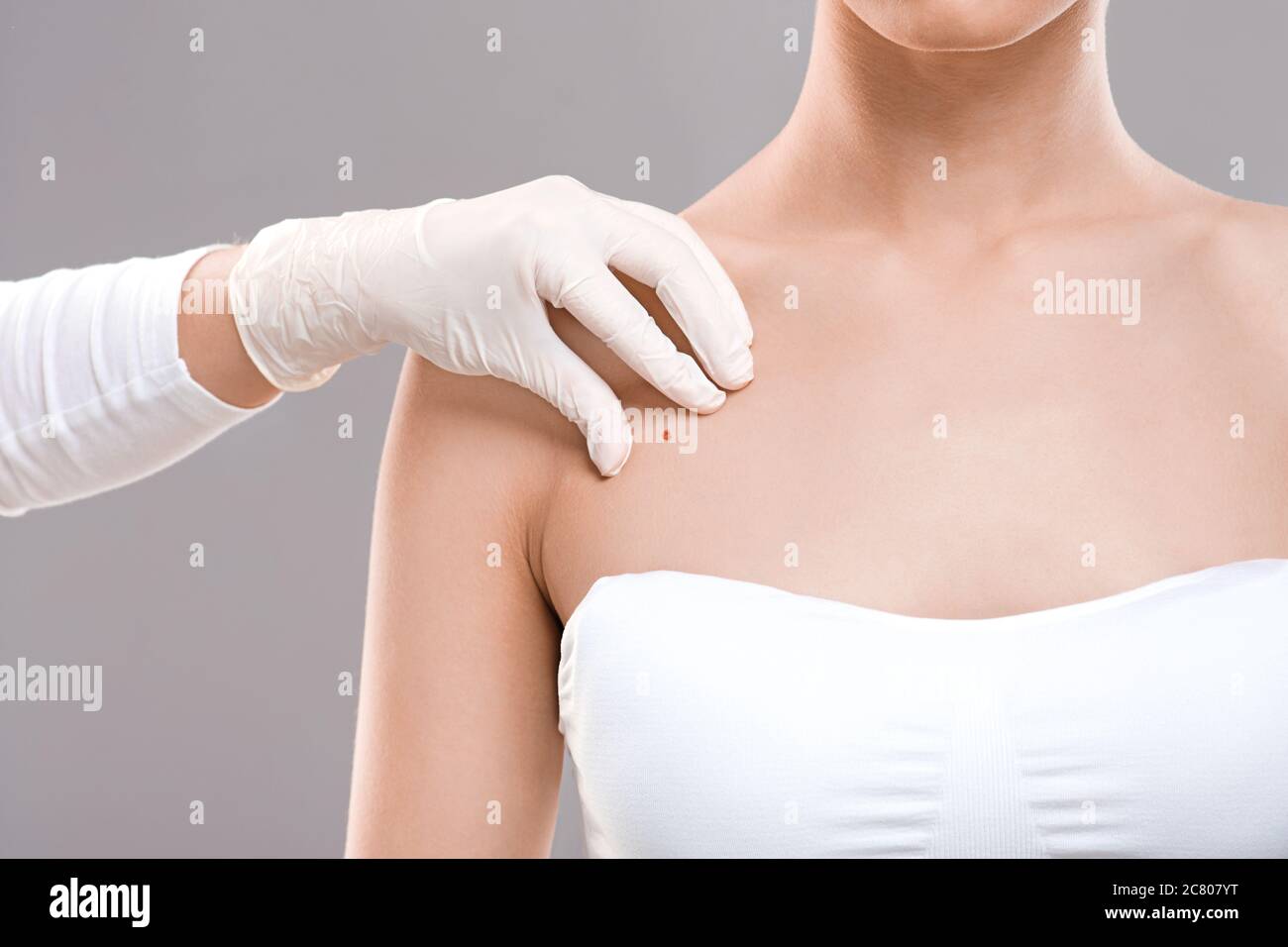 Dermatologist examining birthmark on woman body, cropped Stock Photo