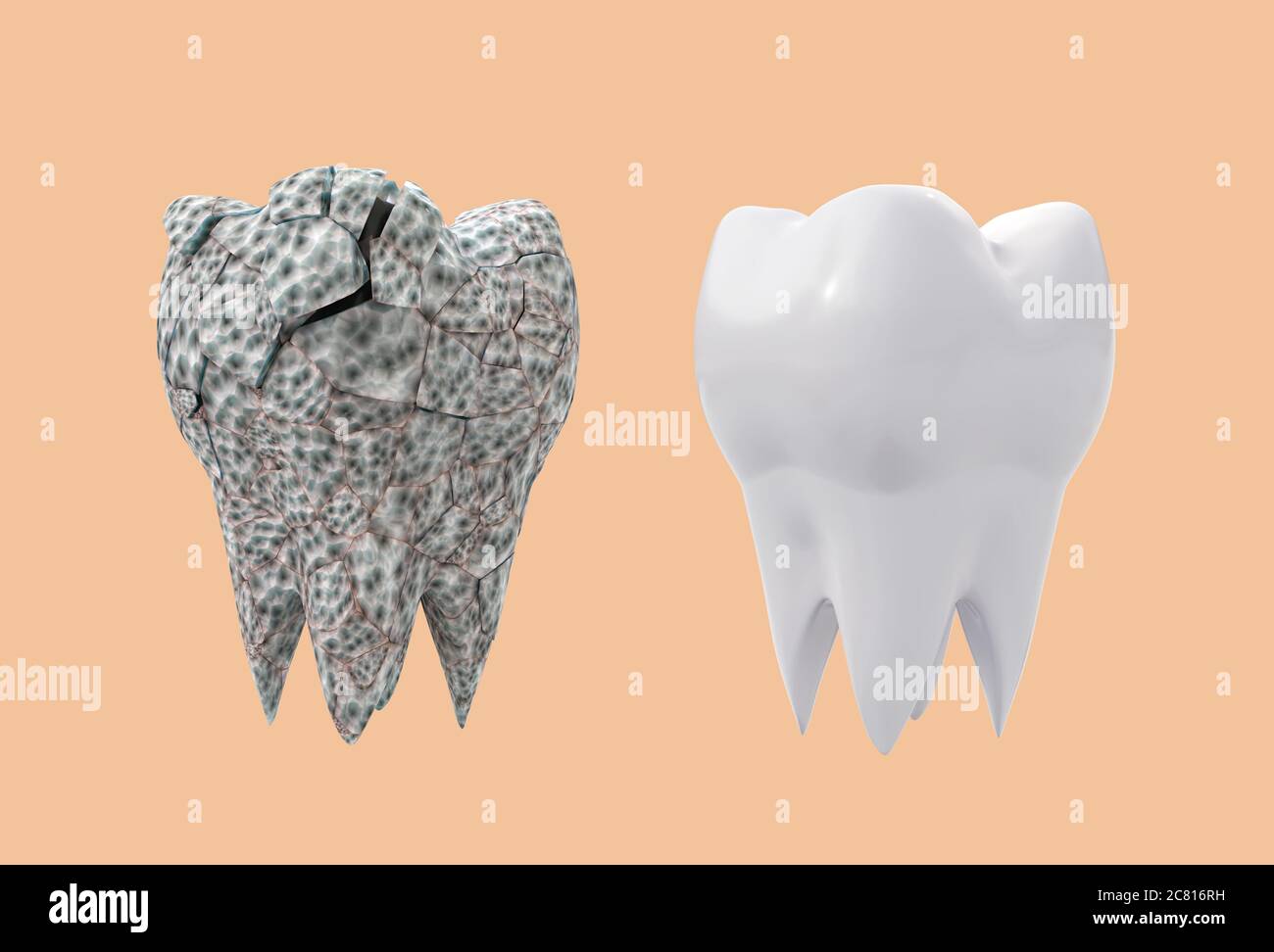 affected broken molar tooth and clean white tooth isolated on orange background. 3d illustration Stock Photo