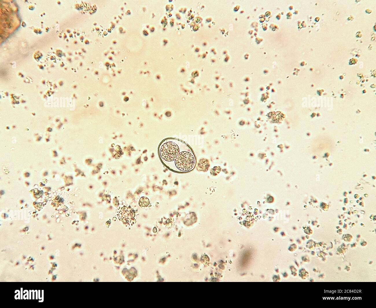isospora spp oocyst under the microscope Stock Photo