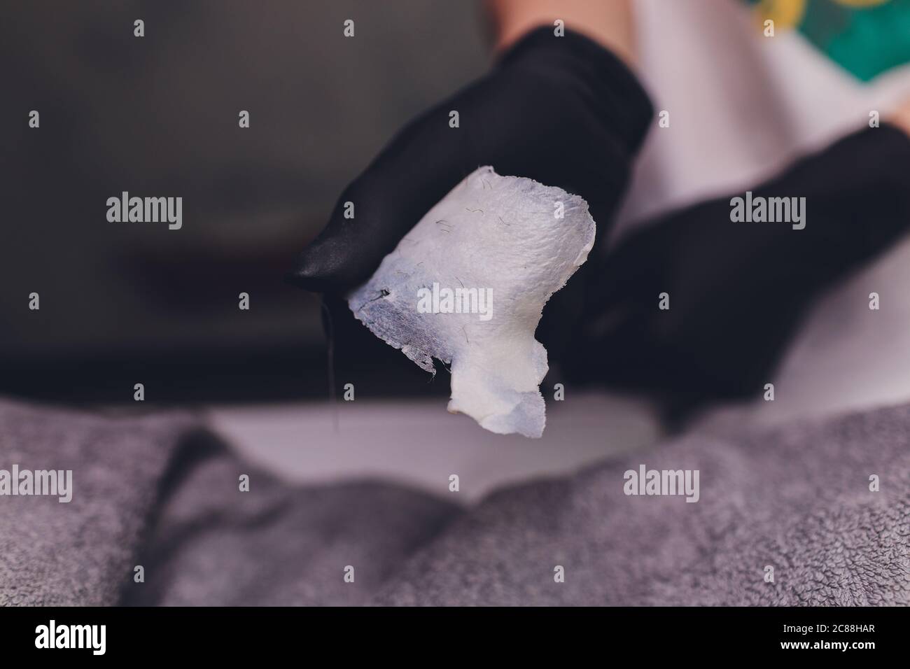 Sugaring epilation with liquate sugar at armpit. It is less painful