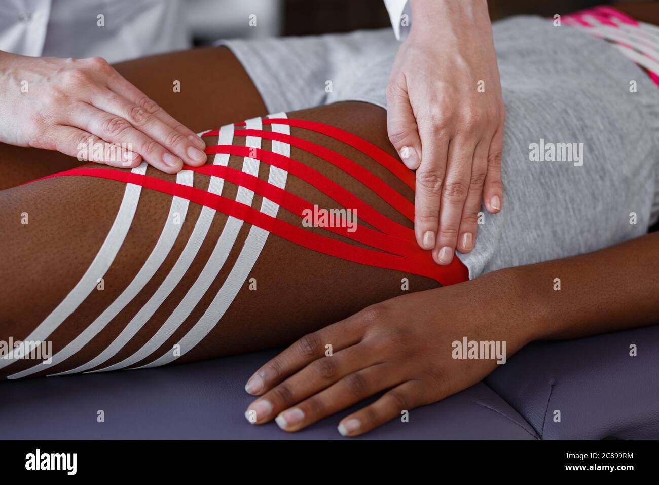Kinesiology taping. Physiotherapist applying kinesiology tape to