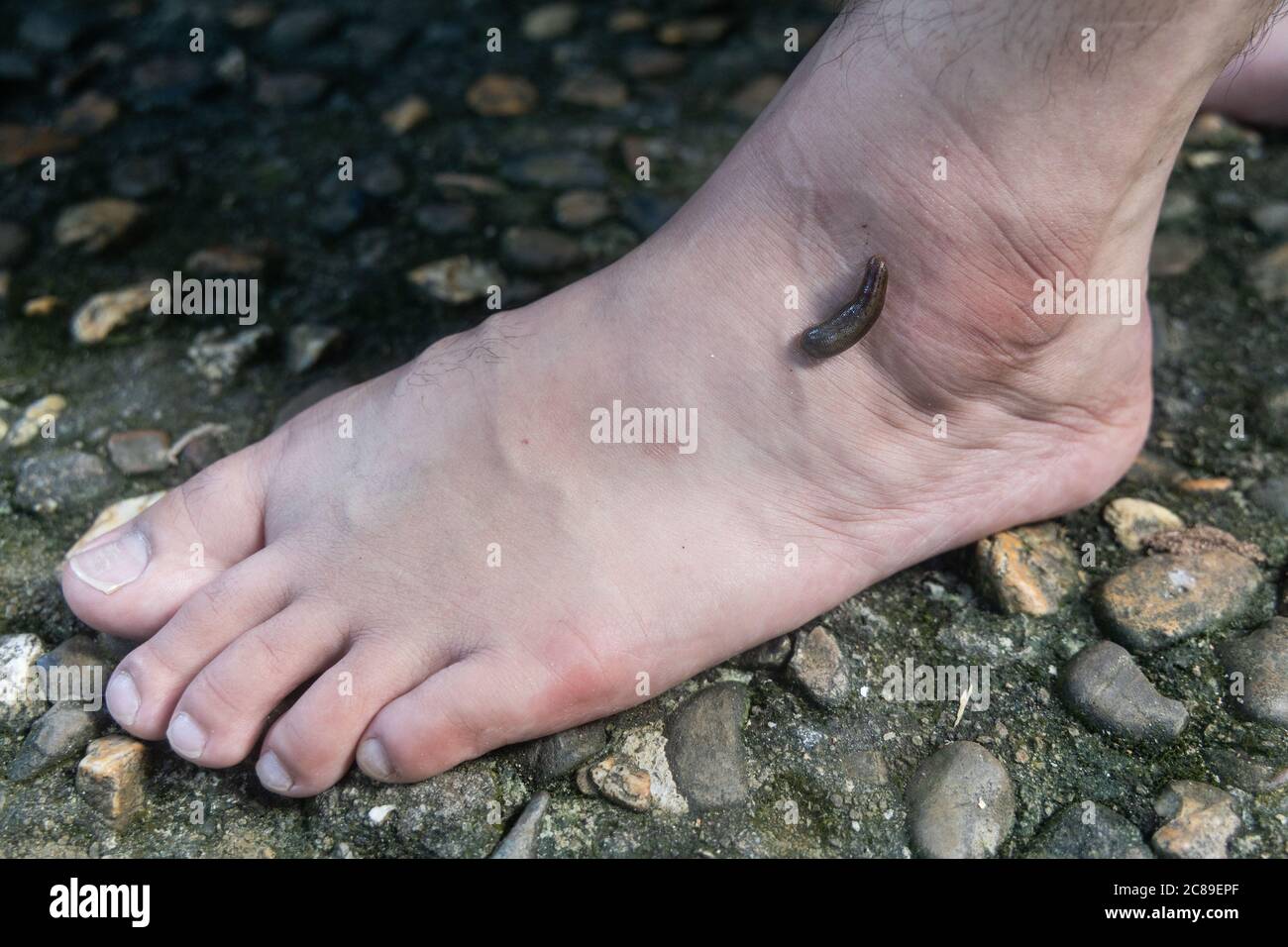 Leech attach biting on leg foot in tropical forrest Stock Photo
