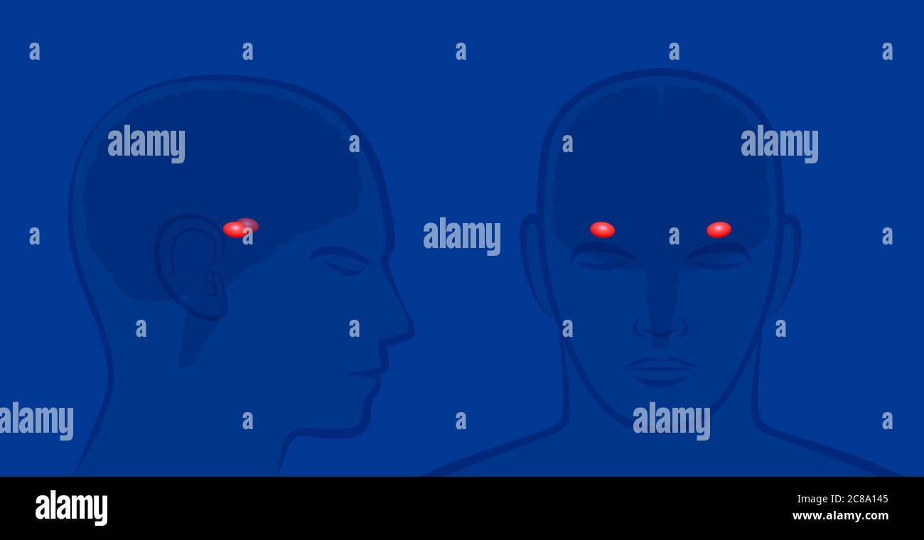 Amygdalas in a human brain. Lateral and frontal view with position of amygdalae - illustration on blue background. Stock Photo