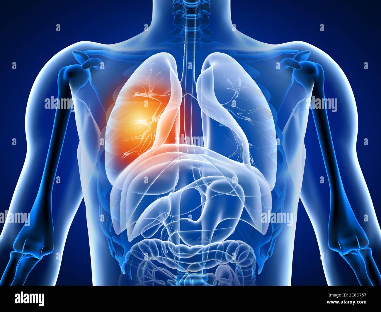 3d illustration human body with lung pain. Stock Photo