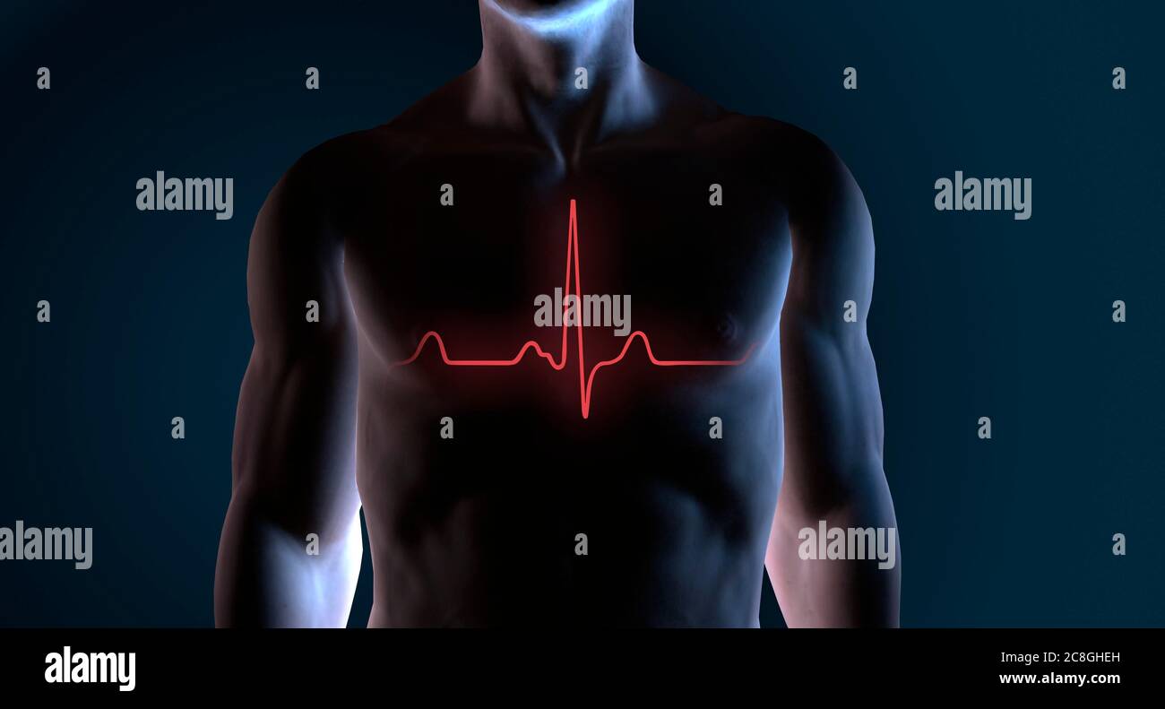 Digital Composing, ECG on male upper body, symbolic picture, Germany Stock Photo