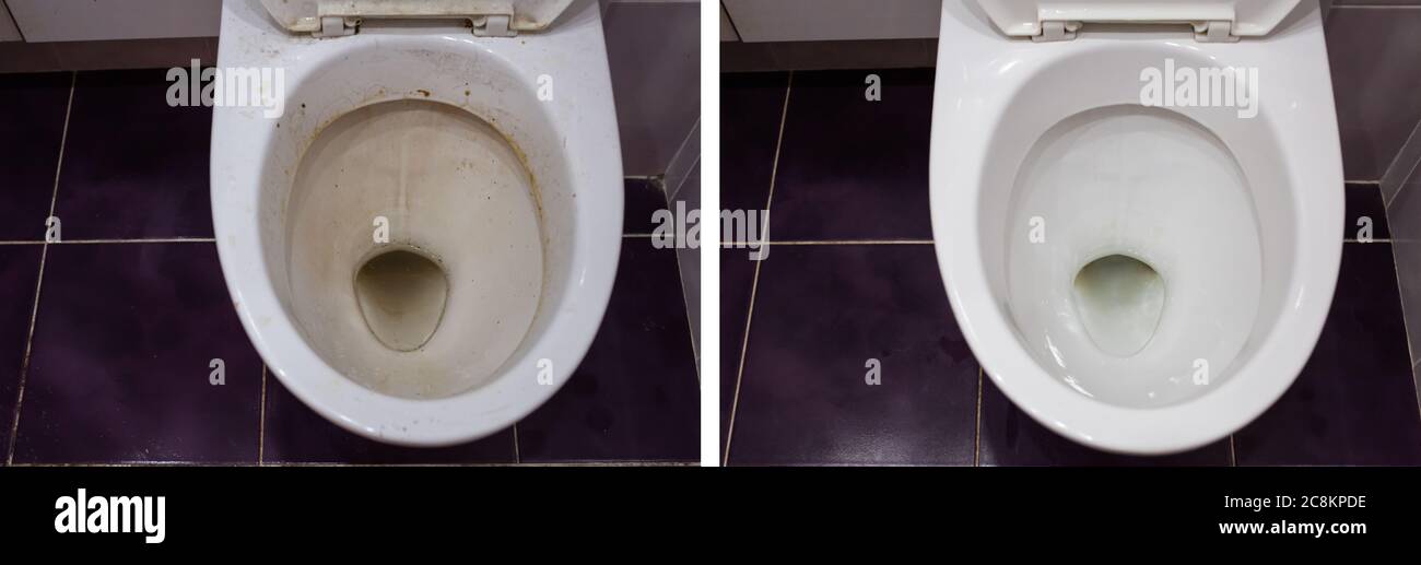Collage. Clean and dirty toilet in the bathroom. White toilet after cleaning detergent Stock