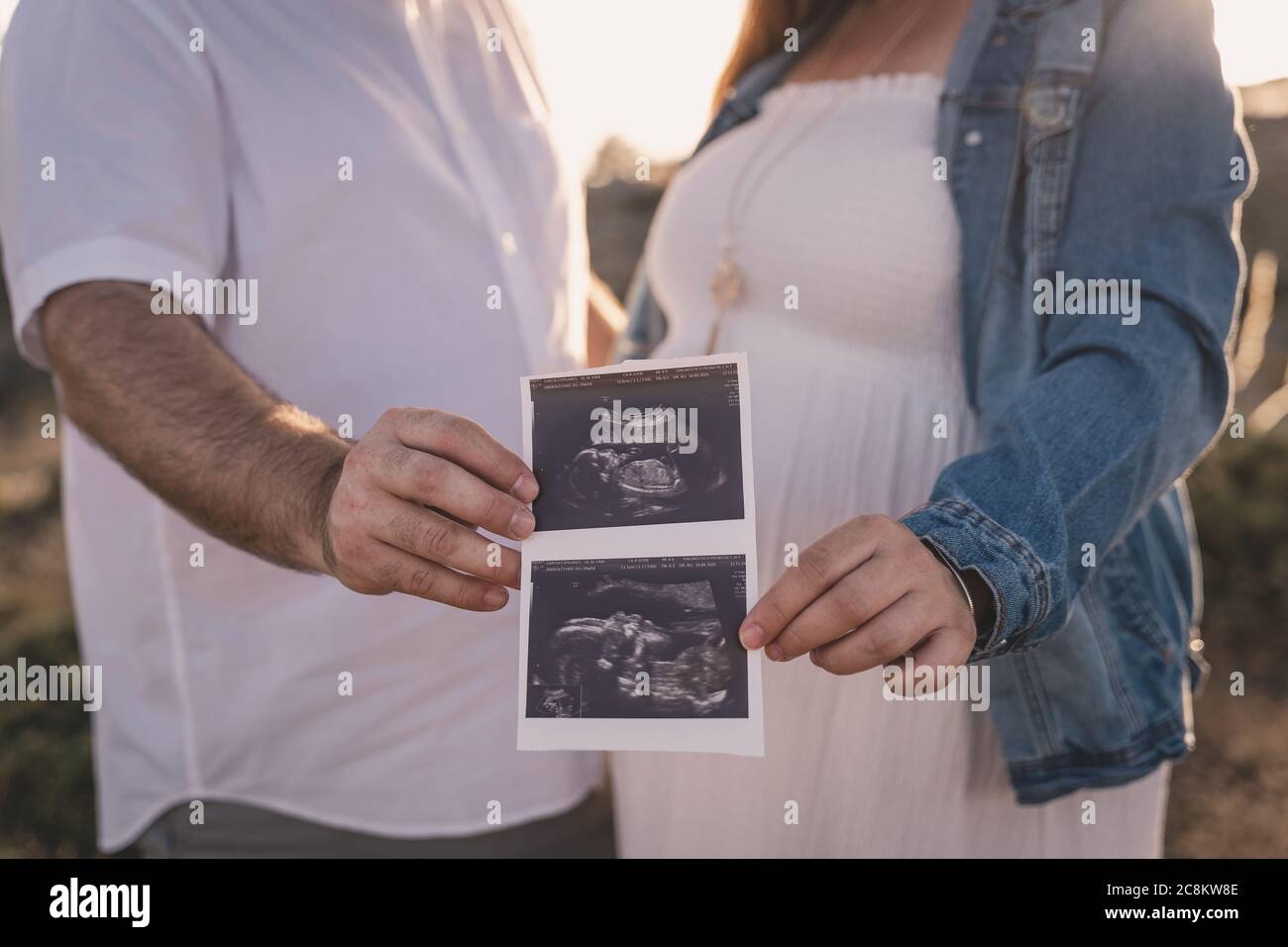 A pregnant woman looking at her echography. Stock Photo