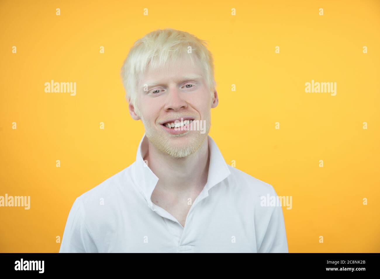Happy smiling albino man white skin hair studio dressed t-shirt isolated yellow background abnormal deviations unusual appearance abnormality Beautiful people Stock Photo