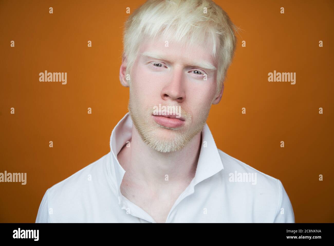 albinism Sad albino man white skin hair studio dressed t-shirt isolated yellow background. abnormal deviations. unusual appearance. skin abnormality Beautiful people with special appearance. Stock Photo